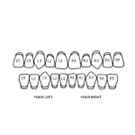 Iced Bow Double Cap Grillz - Image 2