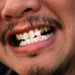 Ice Cream Cone Drip Enamel Grillz - Image 4