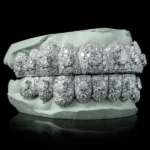 Iced VVS Moissanite Grillz with Large Center Stone - Image 2