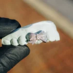 Iced Bow Double Cap Grillz - Image 3