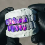 Iced Opals with VVS Moissanite Drips Grillz - Image 2