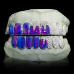 Iced Opals with VVS Moissanite Drips Grillz