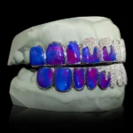 Iced Opals with VVS Moissanite Drips Grillz - Image 4
