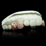 Solid and Iced Top Double Cap Grillz - Image 2