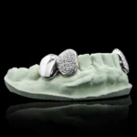 Solid and Iced Bottom Double Cap Grillz - Image 3